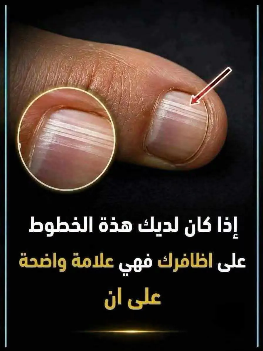 خطوط الاظافر