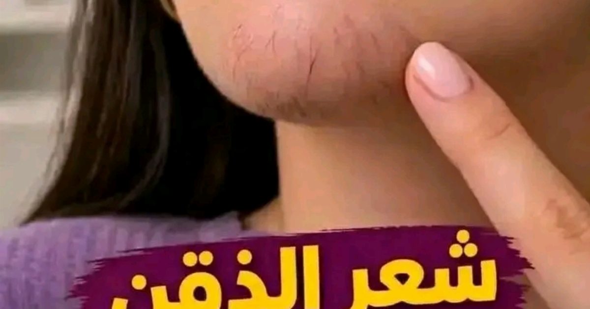 اذا كنتي تعـ.ـاني من ظهور شعر الذقن, انتبهي أليكِ