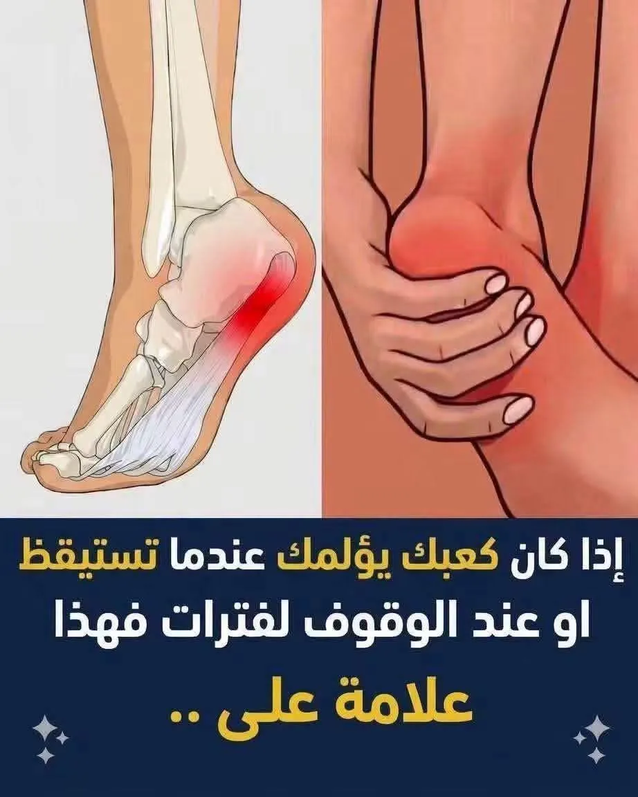 اسبـ.ـاب الـ.ـم كعب القدم