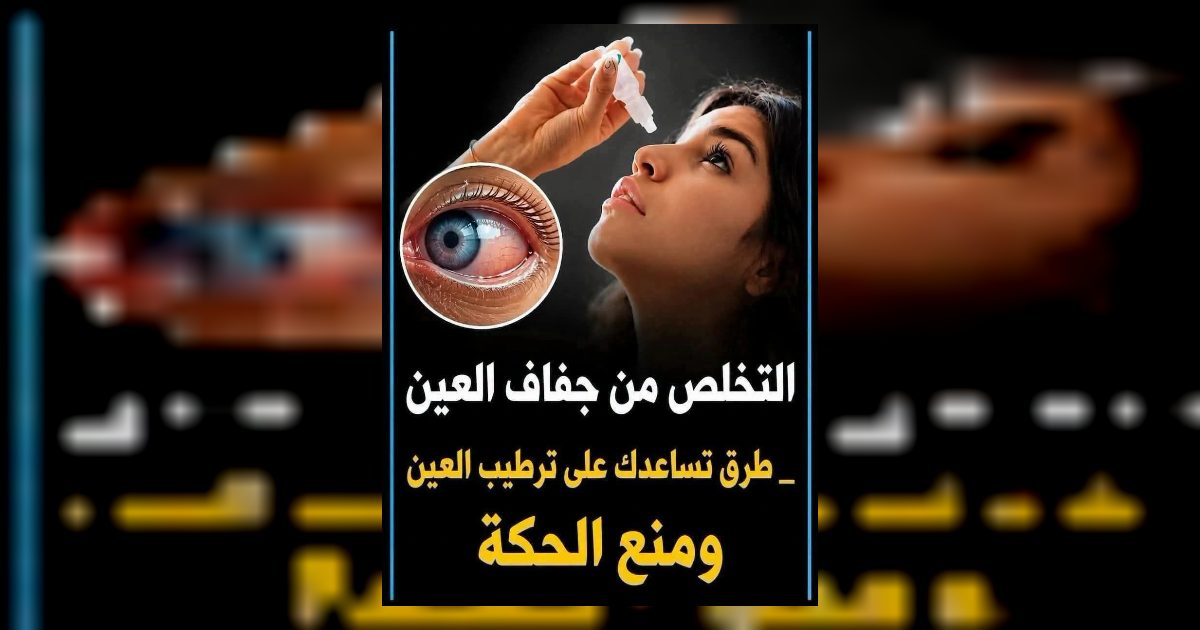 علاج جفاف العين
