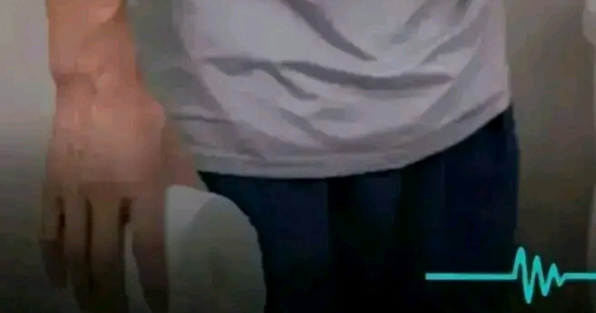هل خروج البـ ـراز على هيئة قطع صغيرة، ممكن أن يكون علامة على الإصـابة ببعض الأمراض؟..ت
