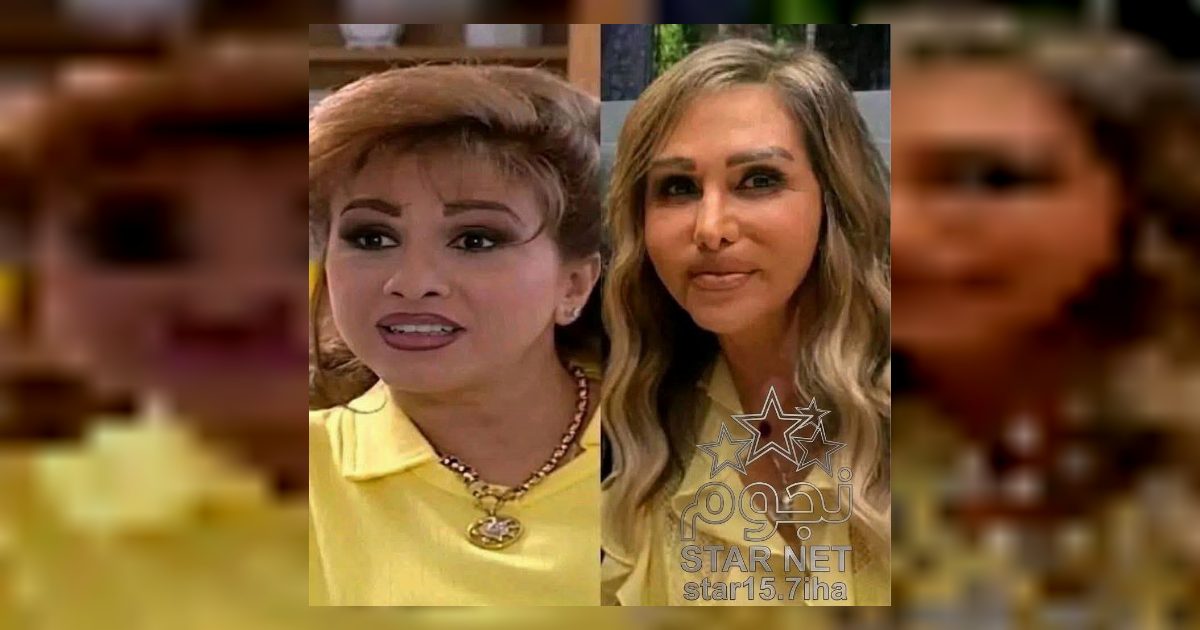 " جميله الشاشة مها المصري !! " تشوه وجه الفنانة السورية مها المصري