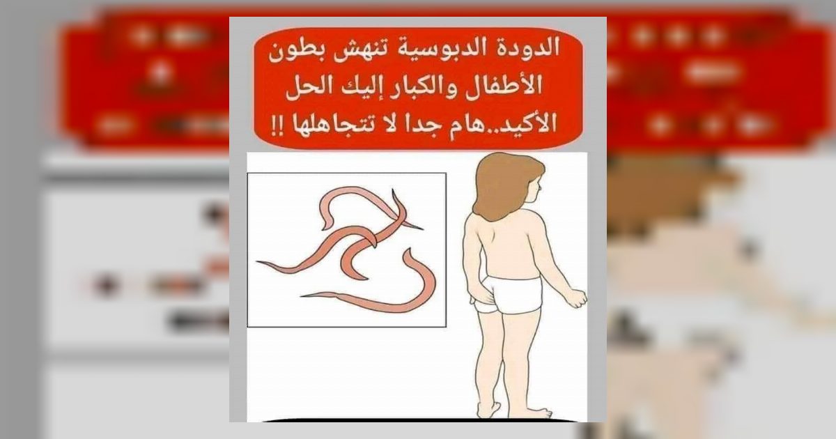 عـ,,ـلاج ديـ,,ـدان البـ,,ـطن