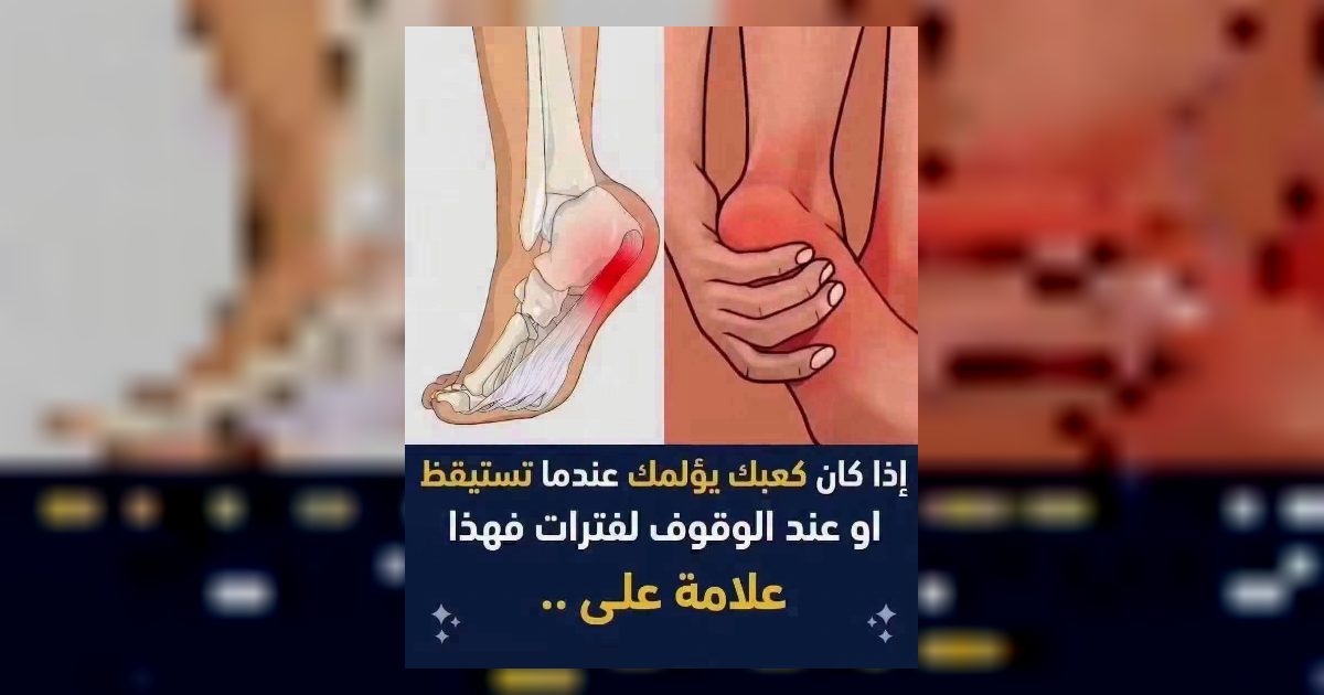 الم كعب القدم الشوكةوالعظمية