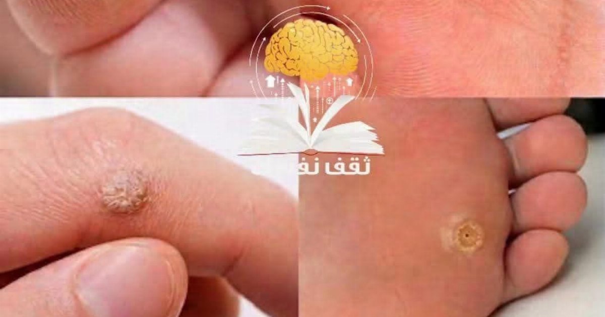 ألـ.ـم مـ.ـزعج مع كل خطوة تمشيها