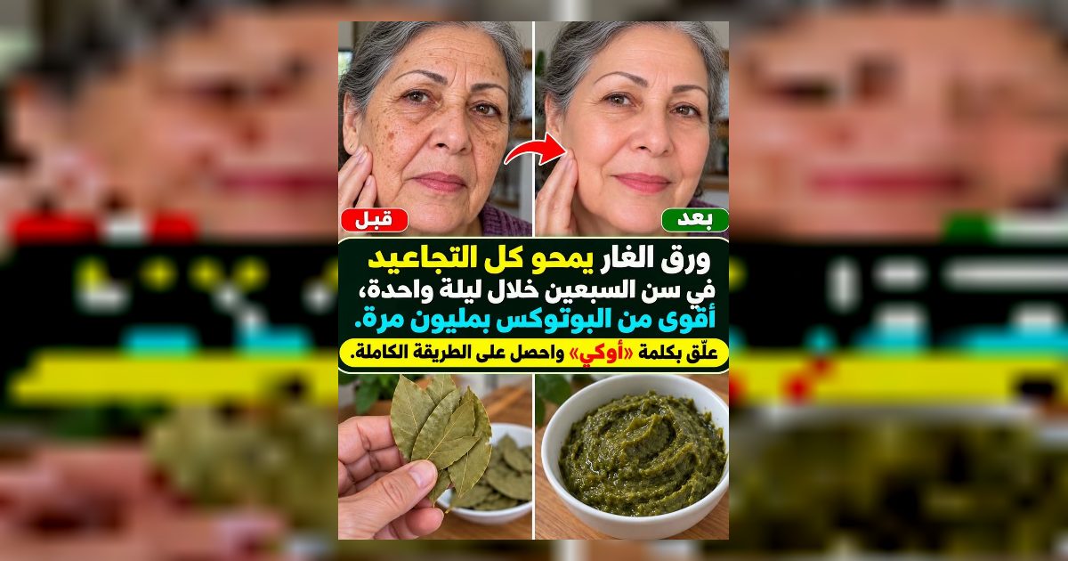 ورق الغار يستهدف البشرة والتجاعيد