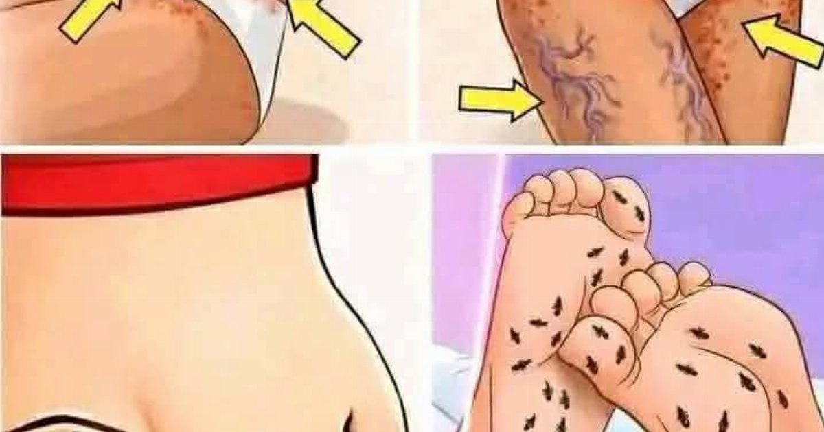 6 علامات لمرض السكري عند النساء  تكرار الألتهابات الفطرية المهبلية ...عرض المزيد