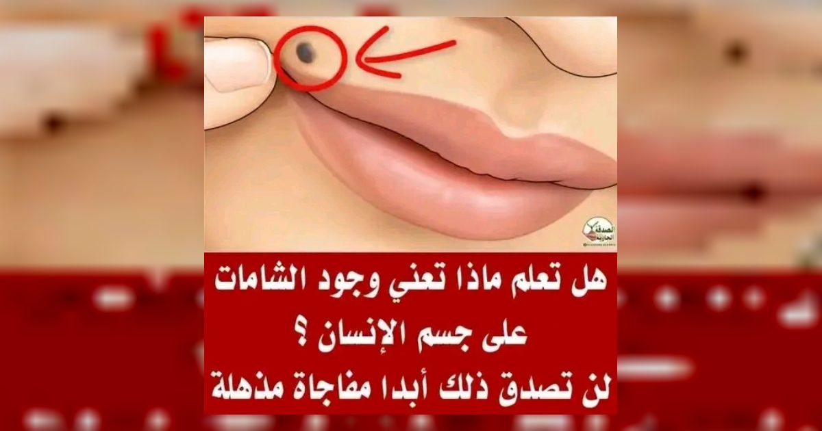 هل تعلم ماذا تعني وجود الشامات علي جسم الإنسان ؟ لن تصدق ذلك أبدا مفاجاة مذهلة؟...