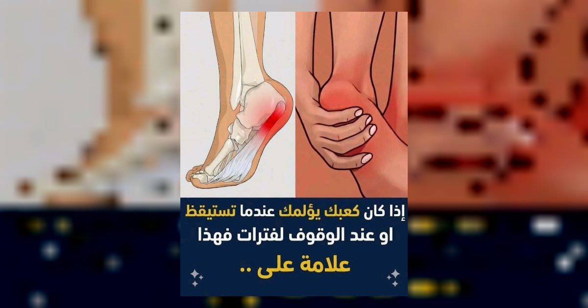 اسبـ.ـاب الـ.ـم كعب القدم عند الاستيقاظ او عند الوقوف لفترات طويلة ..