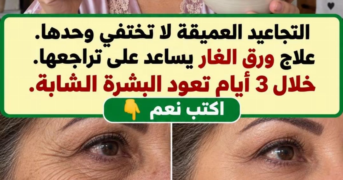 هل يمكن لأوراق الغار أن تزيل التجاعيد العميقة خلال ثلاث ايام