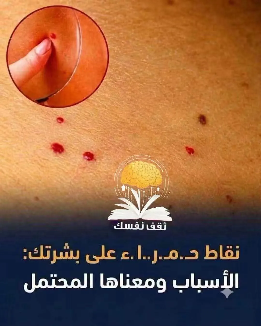 أسبـ.ـاب ظهور نقاط حمـ.ـراء على بشرتك