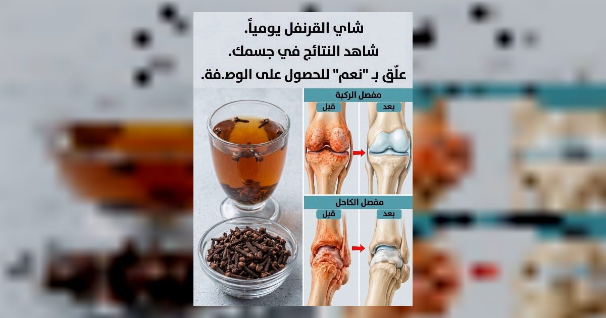 فوائد القرنفل لصحة العظام
