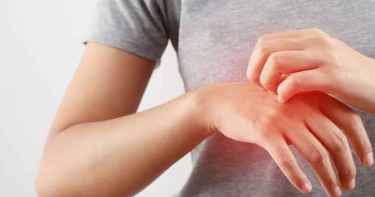 علاج الأمراض الجلدية وأشهر أنواعها وطرق العناية بالبشرة