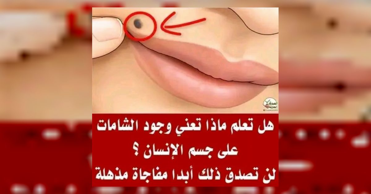 هل تعلم ماذا تعني وجود الشامات علي جسم الإنسان ؟ لن تصدق ذلك أبدا مفاجاة مذهلة؟...اول تعليق👇