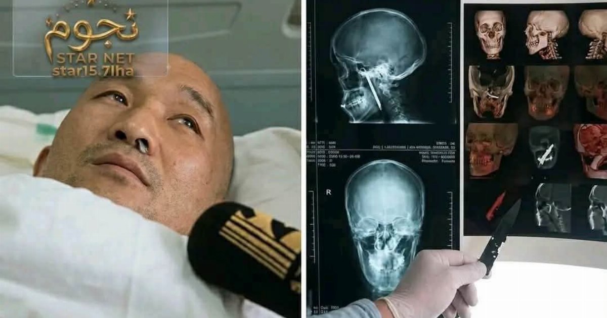 هذا المسكــ,,ـــــين كان يعاني من رائحة فمه
