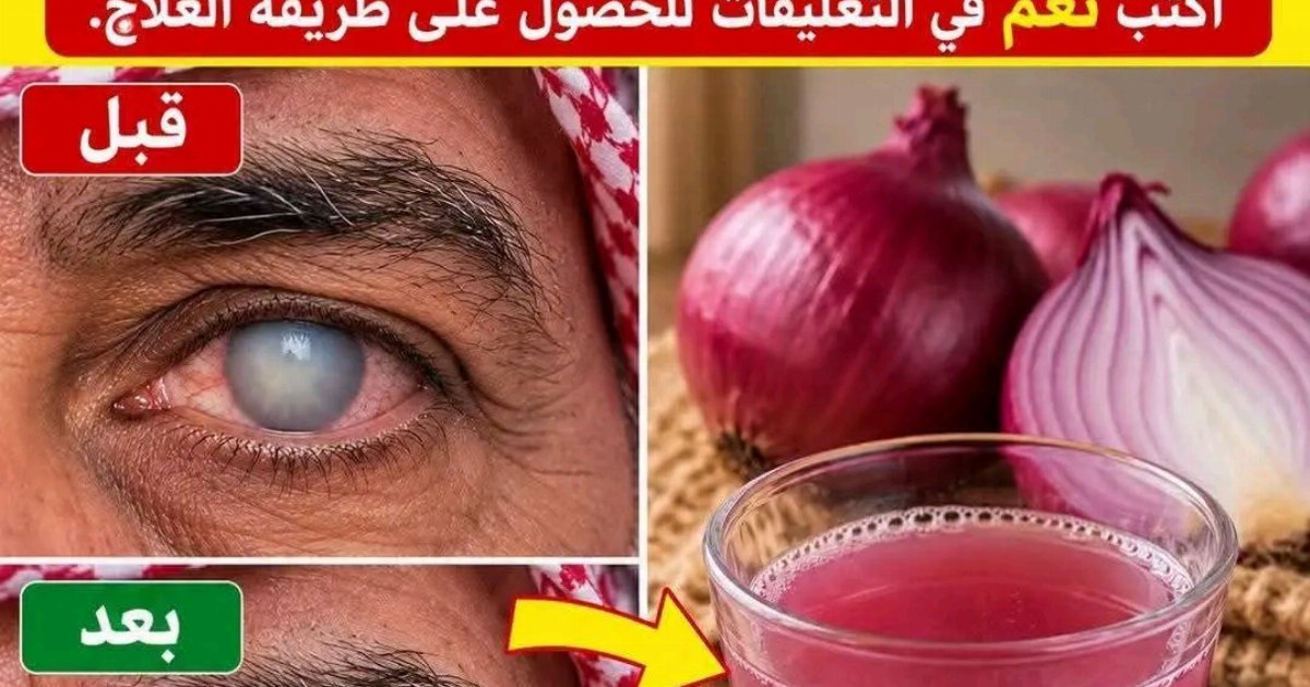 الاطباء يخفون