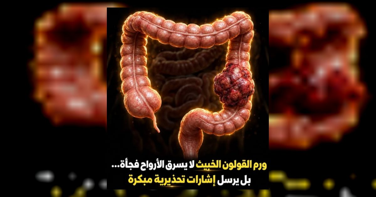 سرطان القولون وعلاماته المبكرة