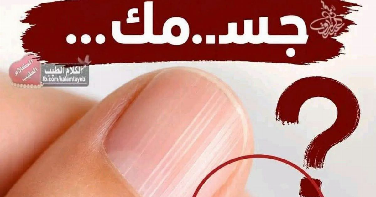 😯وجود أظافر مخططة قد يعني أن جسـ.ـمك... عرض المزيد