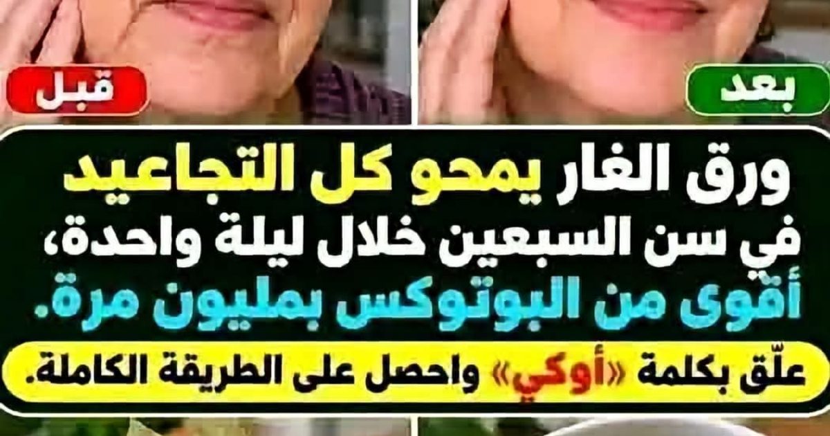 ورق الغار يمحو كل التجاعيد في سن السبعين خلال ليلة واحدة، وبفعالية تفوق البوتوكس